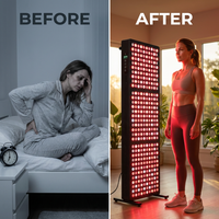 RN300 RN300 — Before & After