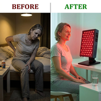 Red Light Therapy, Red near Infrared LED Panel, 72 Quad Chip Flicker Free Leds, Ultra Series, Clinical Grade Device - Popular — Before & After